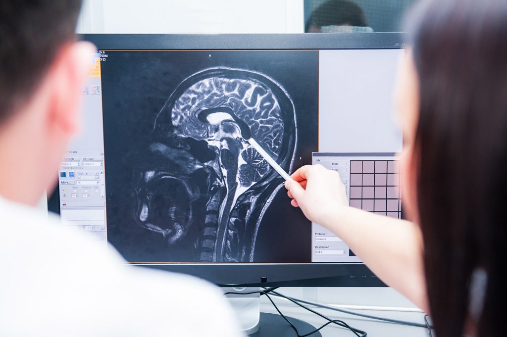 Doctors magnetic resonance image (MRI) injured brain, head injury compensation Leeds